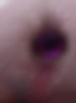 ananus
