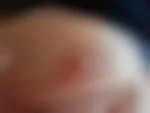 bilisseapoil