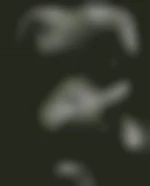 Lid