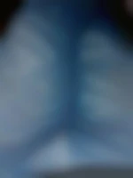 linpa