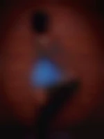 Xcouplex