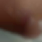 Cc18
