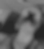 Trezor
