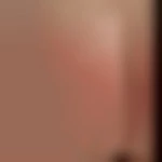 Adisposition