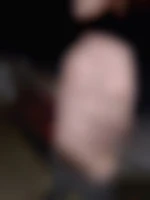 Frankbart