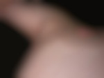 Bichodiscret76