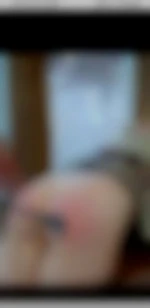 Severepourlope