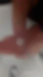 blurp