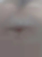 Yon