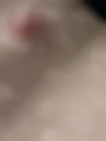 Prepuce63
