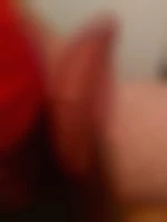 open20