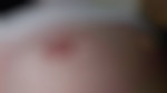 Kamalmed