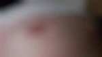 Kamalmed