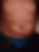 Greg