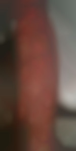 Apolobylka