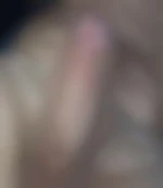 Rictus78